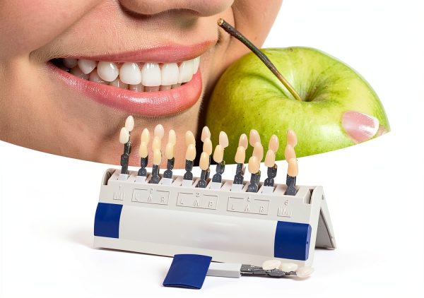 Tooth Shade Whitening Set 29-Color Removable Dental Model by Brrnoo-8