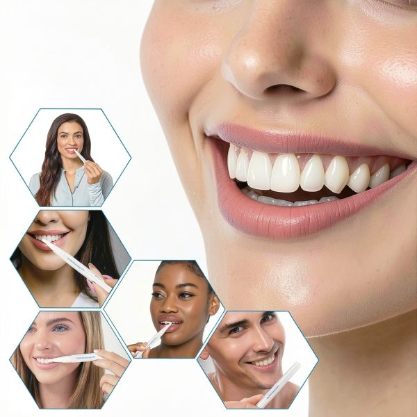 Teeth Whitening Pen Hedhedhed Dental Portable Fast-Acting-6