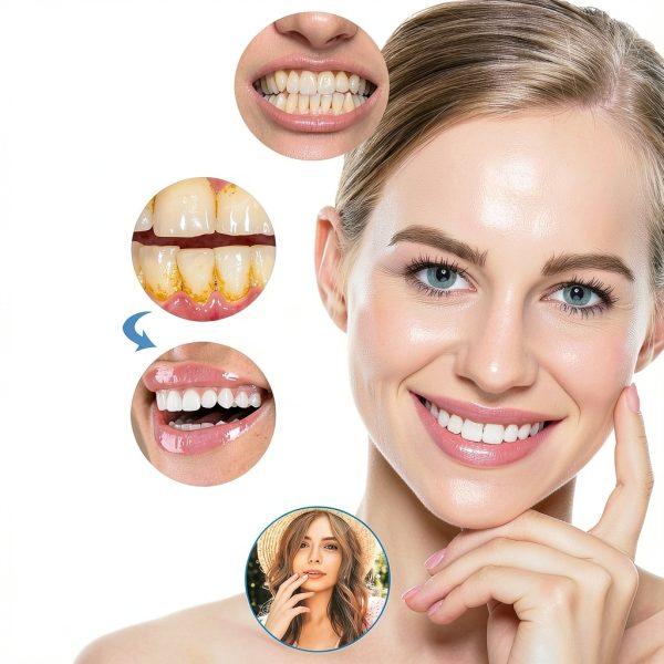 LERSUN Teeth Whitening Pen Model 123 Peppermint Gel 4‑8 Shade Boost-1