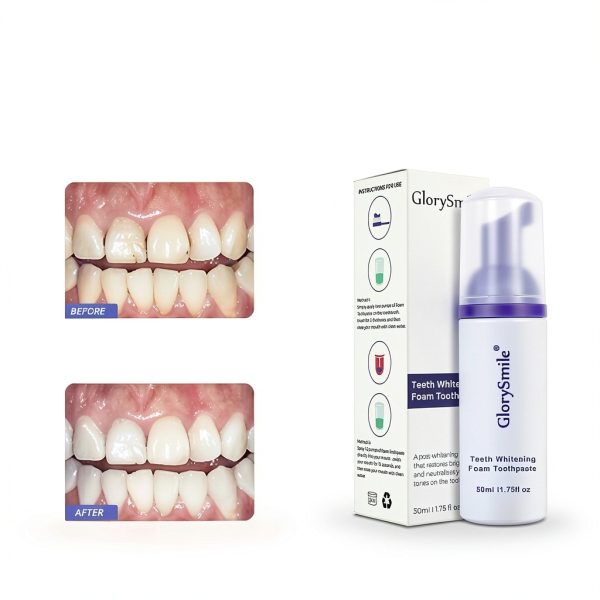 LOQFA Dental Whitening Kit TF8008 Professional 16‑Strip Pack-2