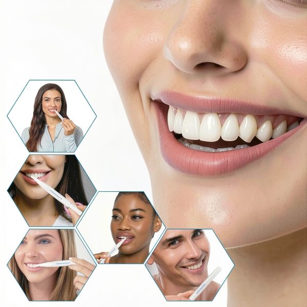 Teeth Whitening Pen Hedhedhed Dental Gel 5.67x2.8x0.75in Portable-6